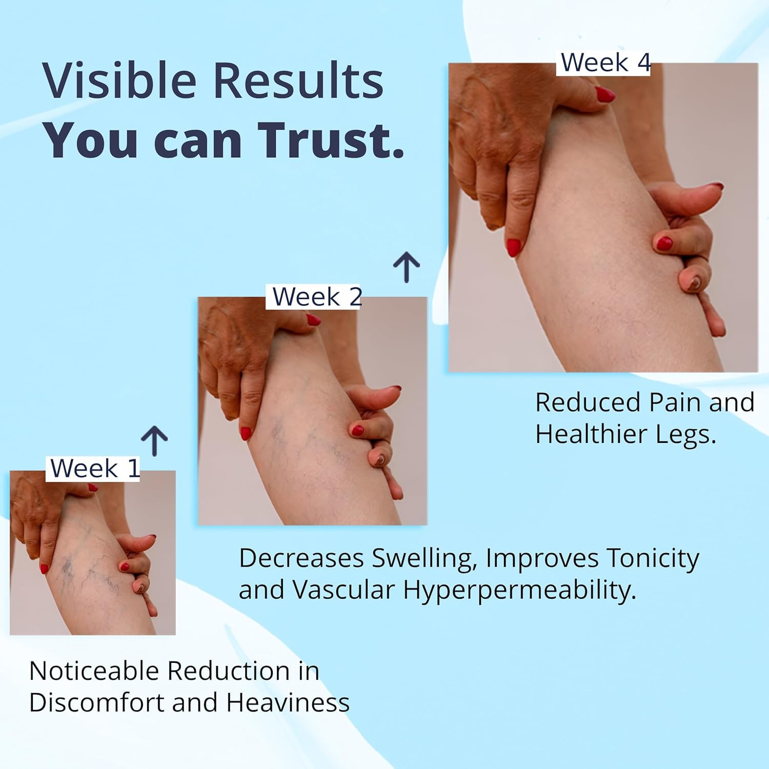 Cream Ayurvedic Solution for Management of Varicose Veins, Spider Veins, Varicocele Helps Reach The Root Cause of varicose Veins Reduces Cramps, Itching & Swelling. Single Tube (25 GMS). GenericBuy Supplements Australia