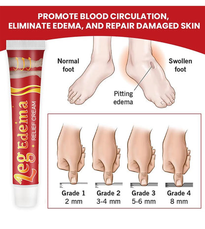 Leg Slimming Massage Cream | Soothing Swelling, Tightening Skin, Auxiliary Care for Reducing Edema （2 Pieces） bobojujuBuy Supplements Australia