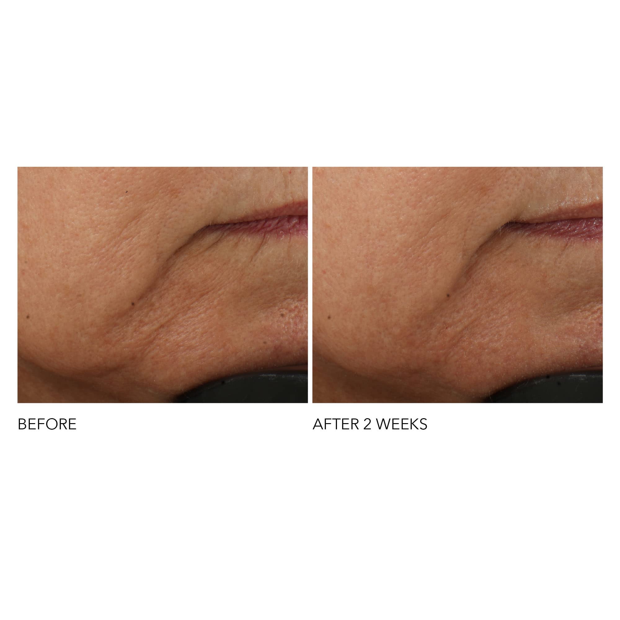 Dr Dennis Gross Advanced Retinol + Ferulic Intense Wrinkle Cream | Intensely Hydrating to Visibly Transform Skin and Repair the Moisture Barrier | 2 oz Dr Dennis GrossBuy Supplements Australia