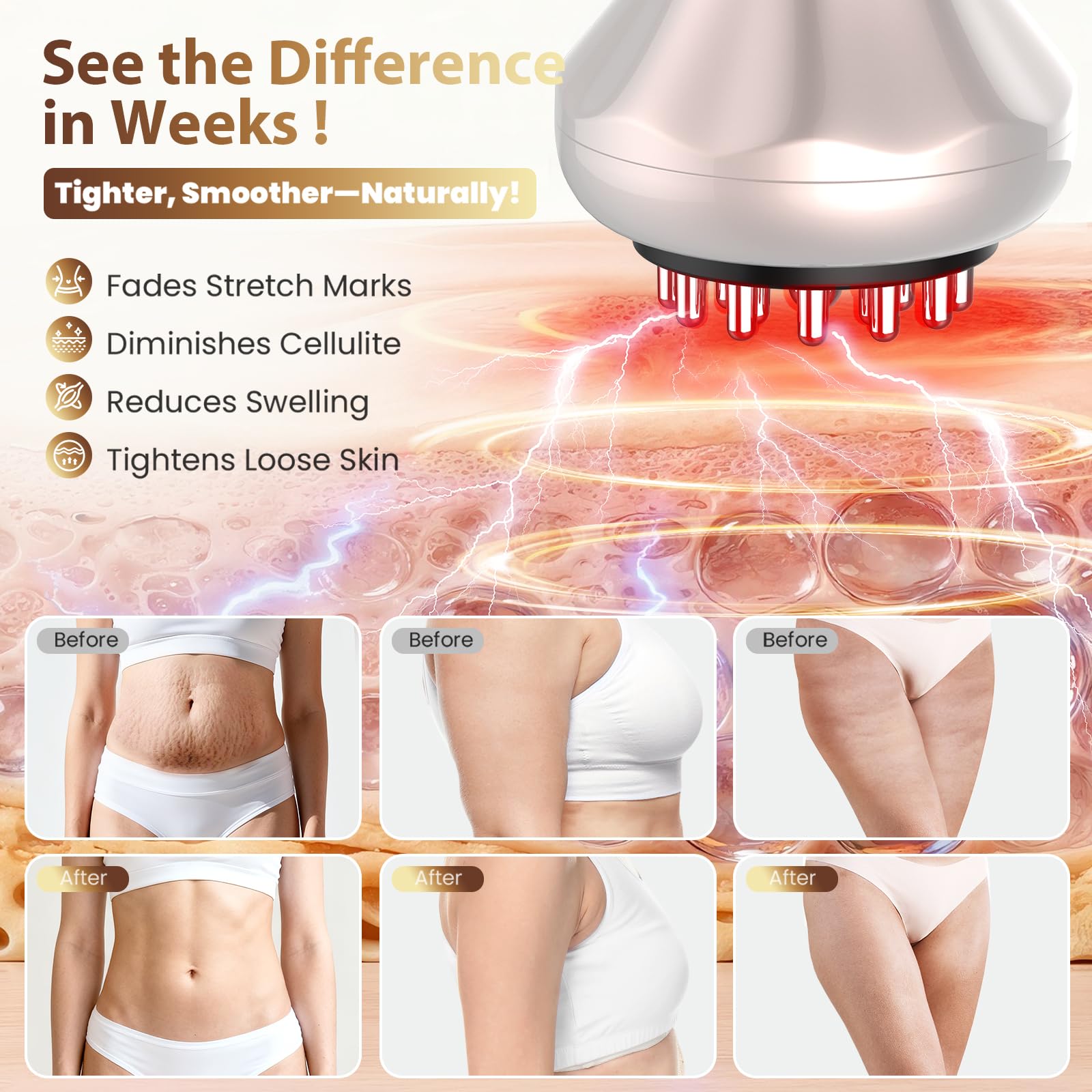 Lymphatic Drainage Massager, Anti Cellulite Massage Tool For Belly & Thigh Stretch Marks & Cellulite Reduction, Handheld Massage tools for Sciatica Nerve, shoulder, Hip, Muscle, Low Back Pain Relief nanagoo buy supplements Au