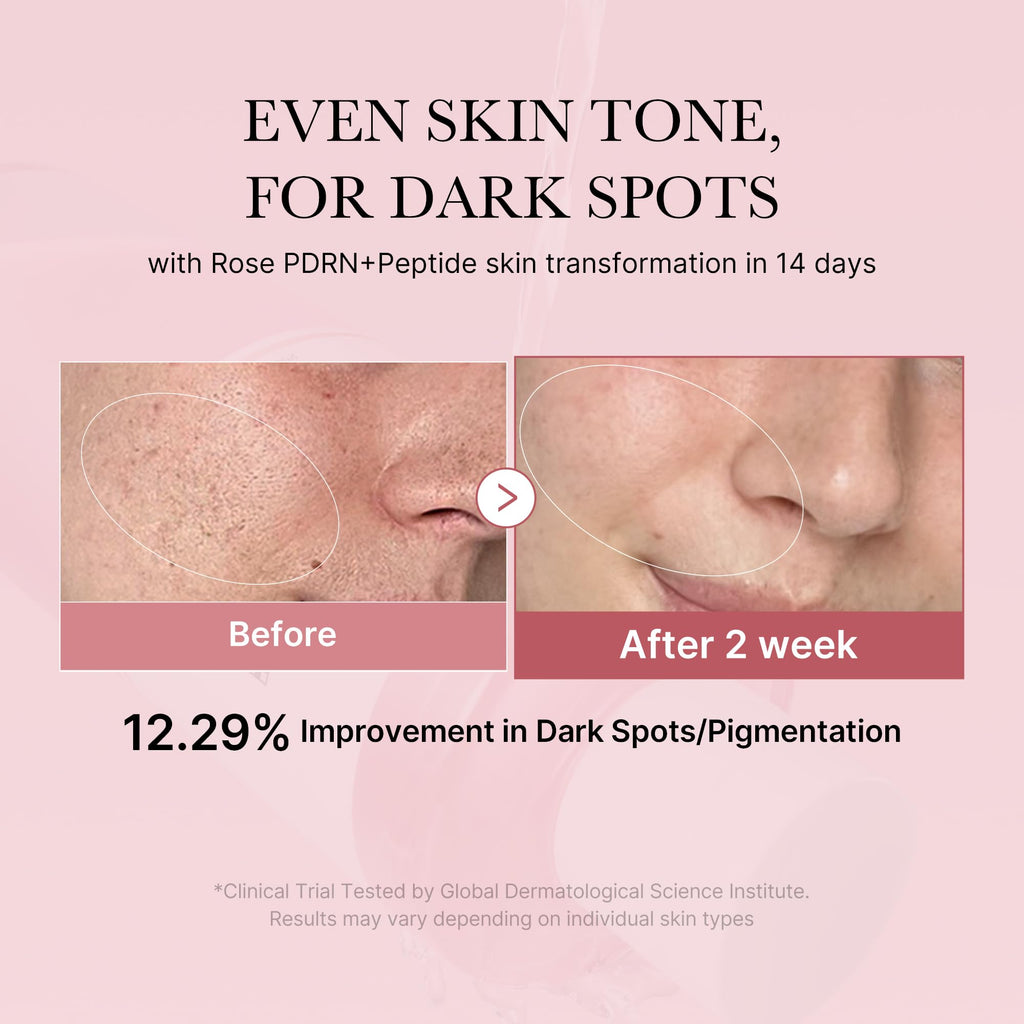 medicube PDRN Toner Rose PDRN Peptide Toner | Lightweight & Watery Type for Skin Boosting, Soothing and Calming, Uneven Skin Tone | with Rose, Peptide, Niacinamide | Korean Skincare, 8.45 fl.oz medicubeBuy Supplements Australia