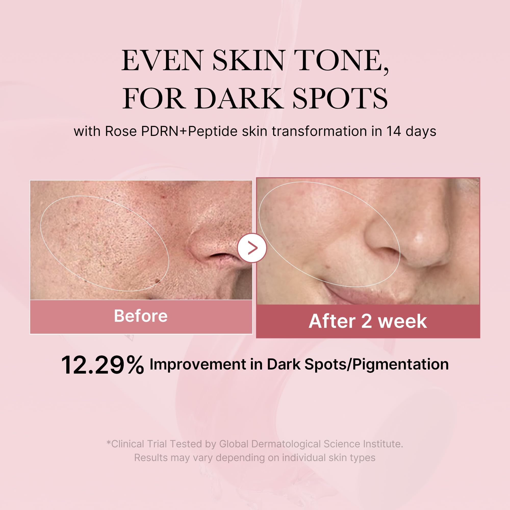 medicube PDRN Toner Rose PDRN Peptide Toner | Lightweight & Watery Type for Skin Boosting, Soothing and Calming, Uneven Skin Tone | with Rose, Peptide, Niacinamide | Korean Skincare, 8.45 fl.oz medicubeBuy Supplements Australia