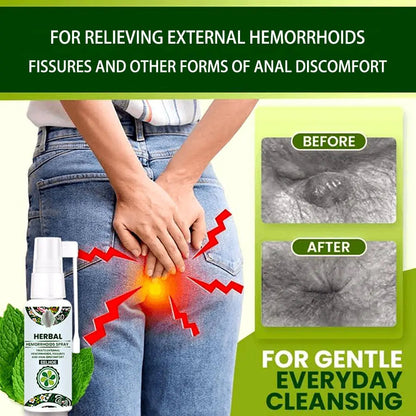 Juztec Hemorrhoid Treatment - Fast Relief with Hemocare Herbal Hemorrhoids Spray & Analese Numb Cream (1 PCS) JuztecBuy Supplements Australia