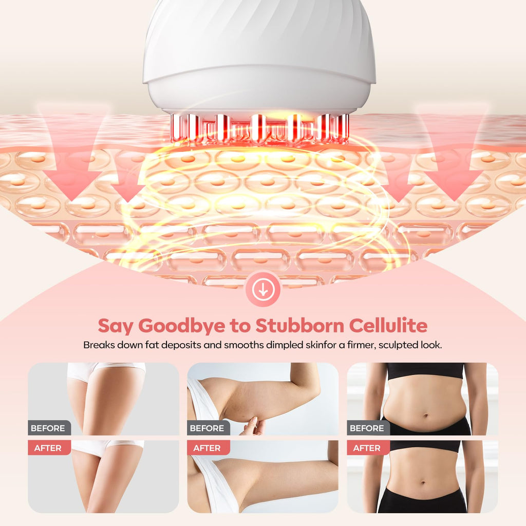 HarrFlow Lymphatic Drainage Massager & Anti Cellulite Massage Tool, Lymphatic Massager,Helps Reduce Stretch Marks & Cellulite，for Belly, Arms & Legs,Body Sculpting Machine with Heat & Vibration HarrFlow buy supplements Au
