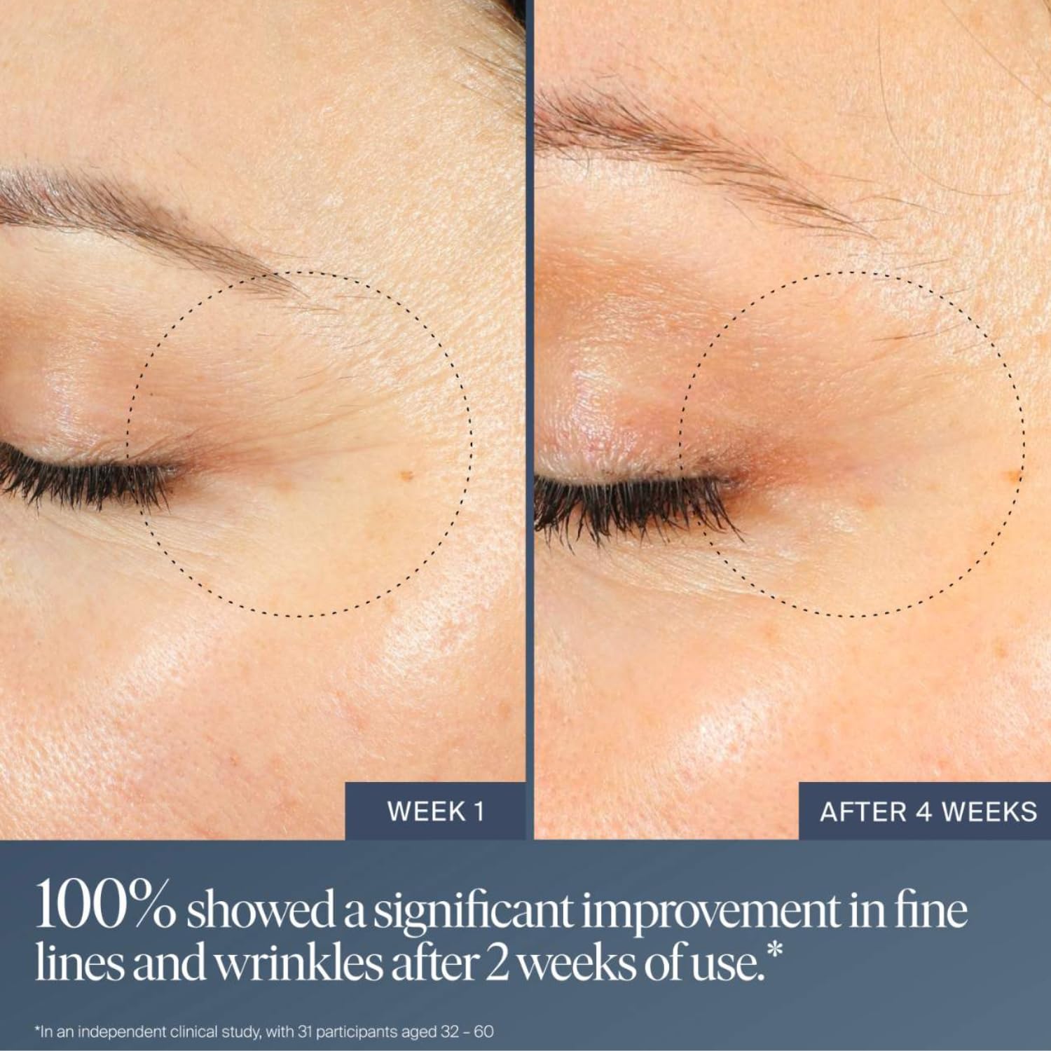 Summer Fridays Jet Lag Overnight Eye Serum - Nourishing Undereye Treatment for Dark Circles - Helps to Hydrate, Smooth, Firm & Depuff - Enriched with Glycerin to Lock in Moisture (0.5 Fl Oz) Summer FridaysBuy Supplements Australia