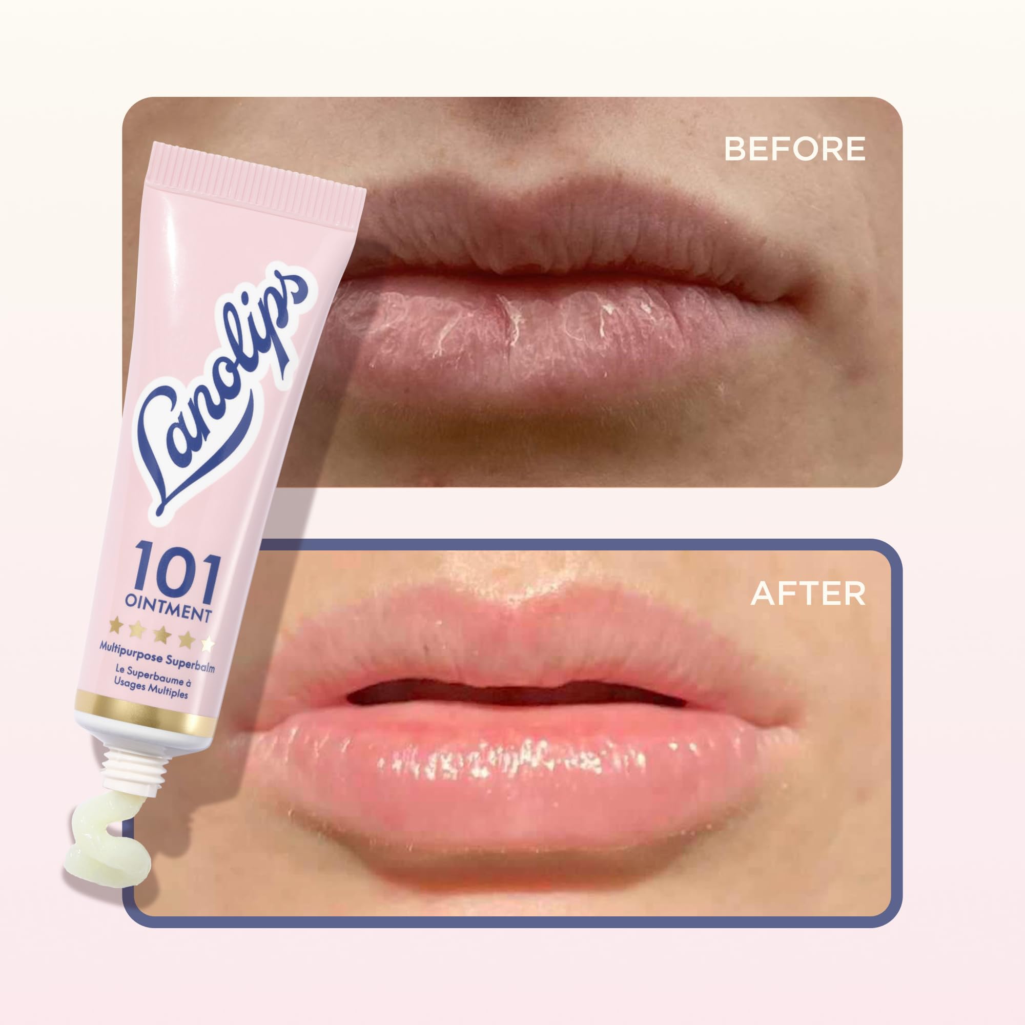 Lanolin 101 Multipurpose Ointment - Lanolin Lip Balm & Healing Ointment for Skin Barrier Repair - Moisturizer for Dry Lips, Cuticles & Elbows - No Petroleum Formula - Original Superbalm (0.52 oz) LanolipsBuy Supplements Australia