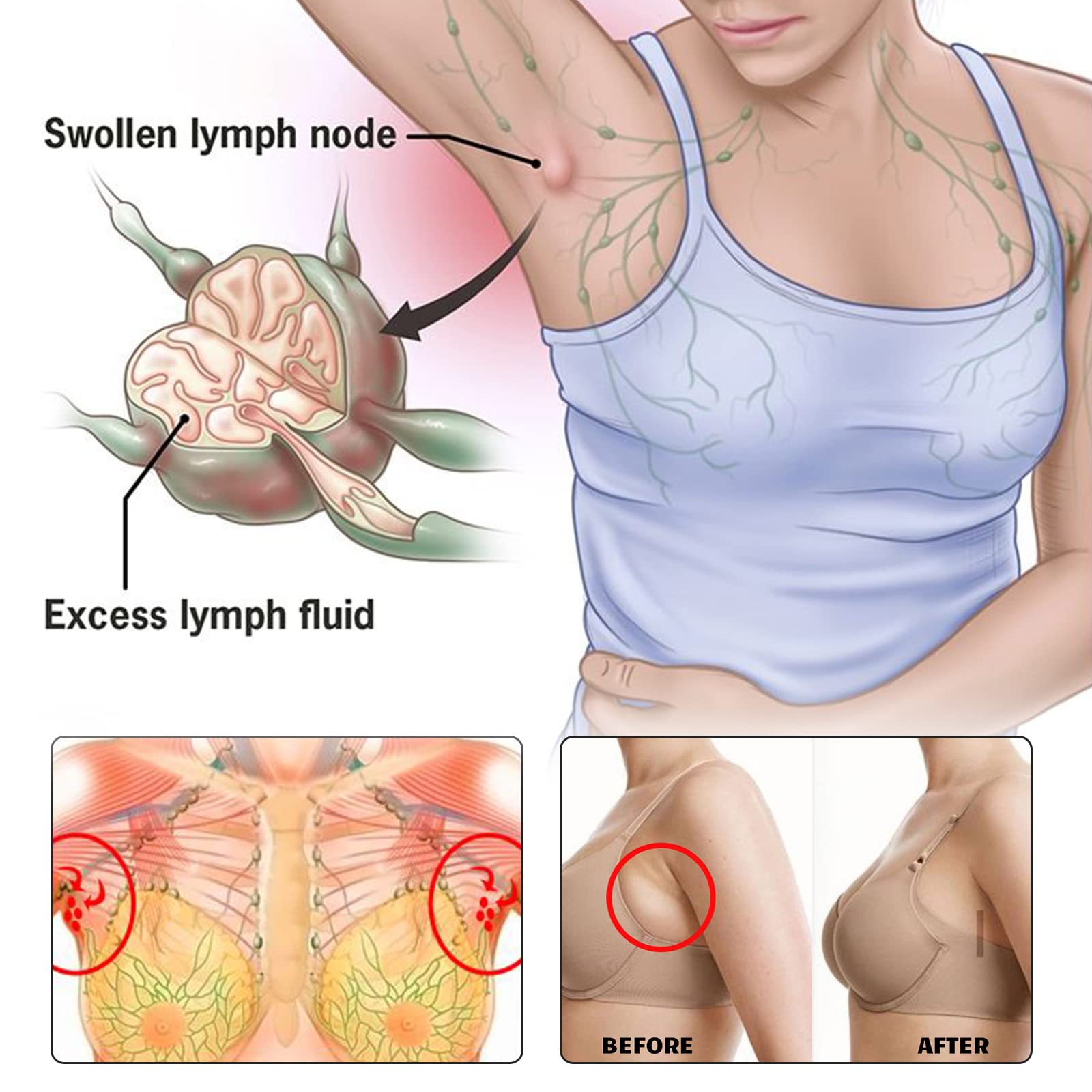 BXQJRJ 24Pcs/Box Herbal Lymph Nodes Patch,Lymphatic Drainage Patch/Patches,Herbal Lymphatic Drainage Care Patch,Neck Lymph Nodes Patch, Lymphatic Massage for Men and Women BXQJRJ buy supplements Au