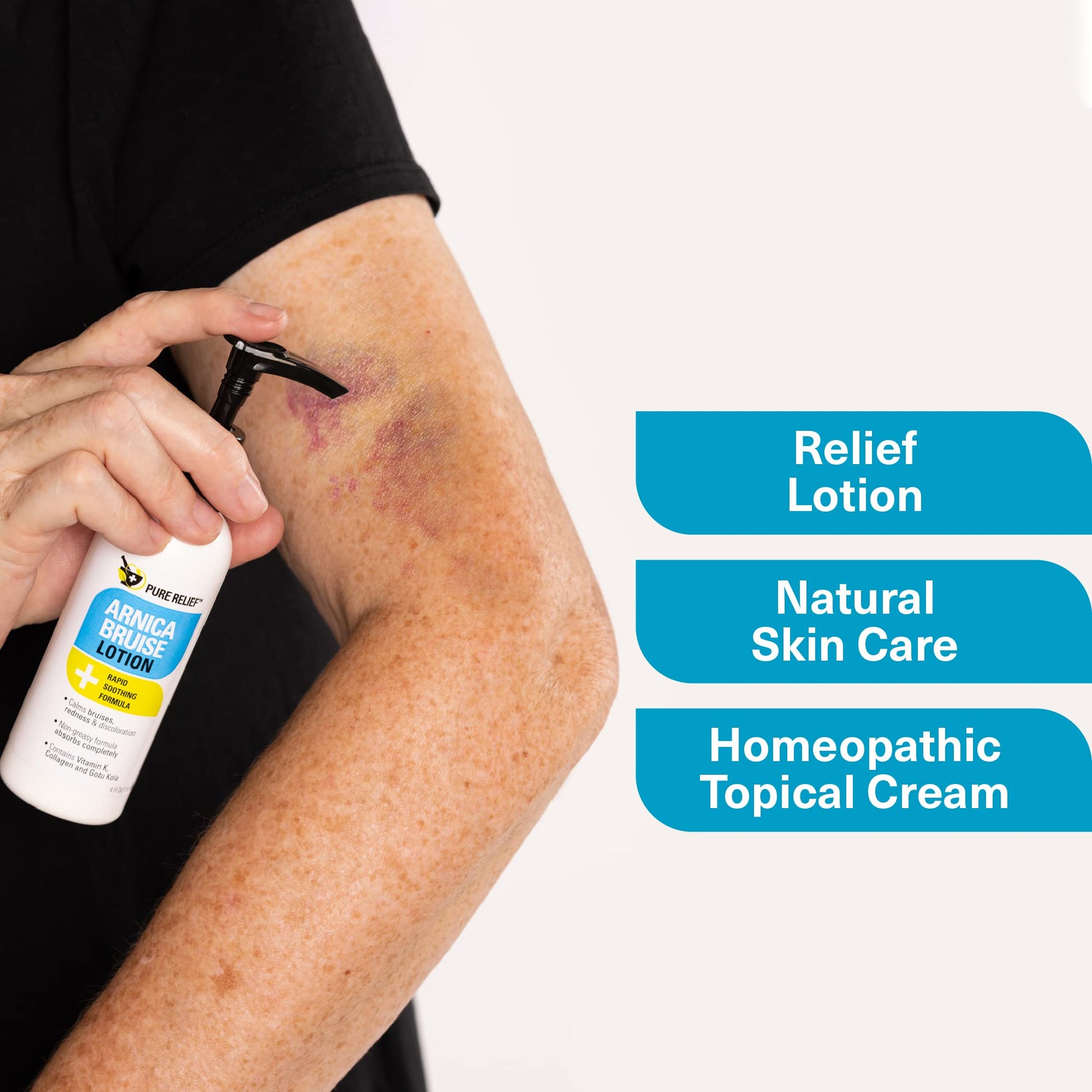 Pure Relief Arnica Bruise Relief Lotion for Bruising, Swelling, & Discoloration On Skin, Natural Skin Care Arnica Bruise Homeopathic Topical Bruise Cream W/Aloe Vera & Collagen, 4 Fl Oz (Pack of 3) Pure ReliefBuy Supplements Australia