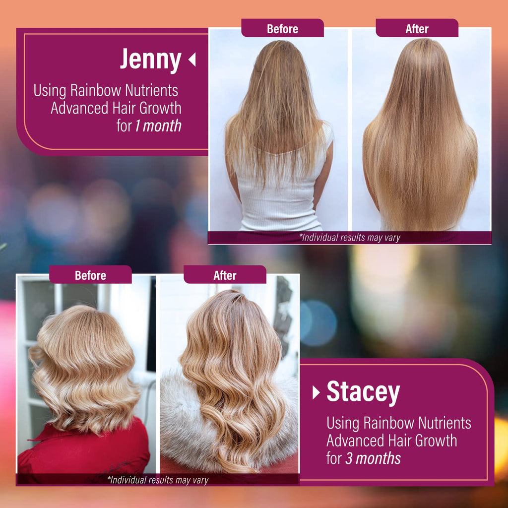 Hair Growth Vitamins for Women | Biotin 10,000mcg, Collagen, Patented OptiMSM®, goMCT