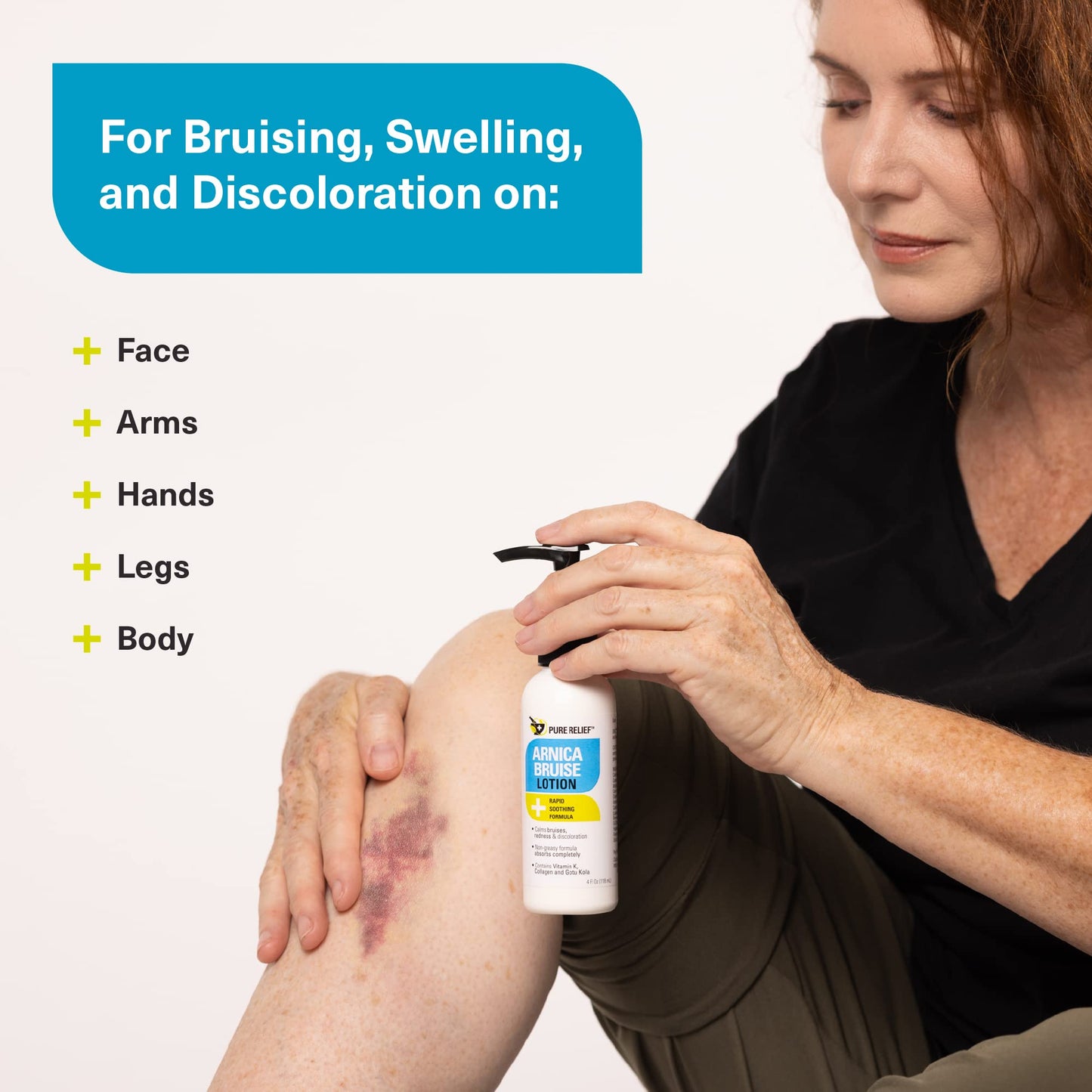 Pure Relief Arnica Bruise Relief Lotion for Bruising, Swelling, & Discoloration On Skin, Natural Skin Care Arnica Bruise Homeopathic Topical Bruise Cream W/Aloe Vera & Collagen, 4 Fl Oz (Pack of 3) Pure ReliefBuy Supplements Australia