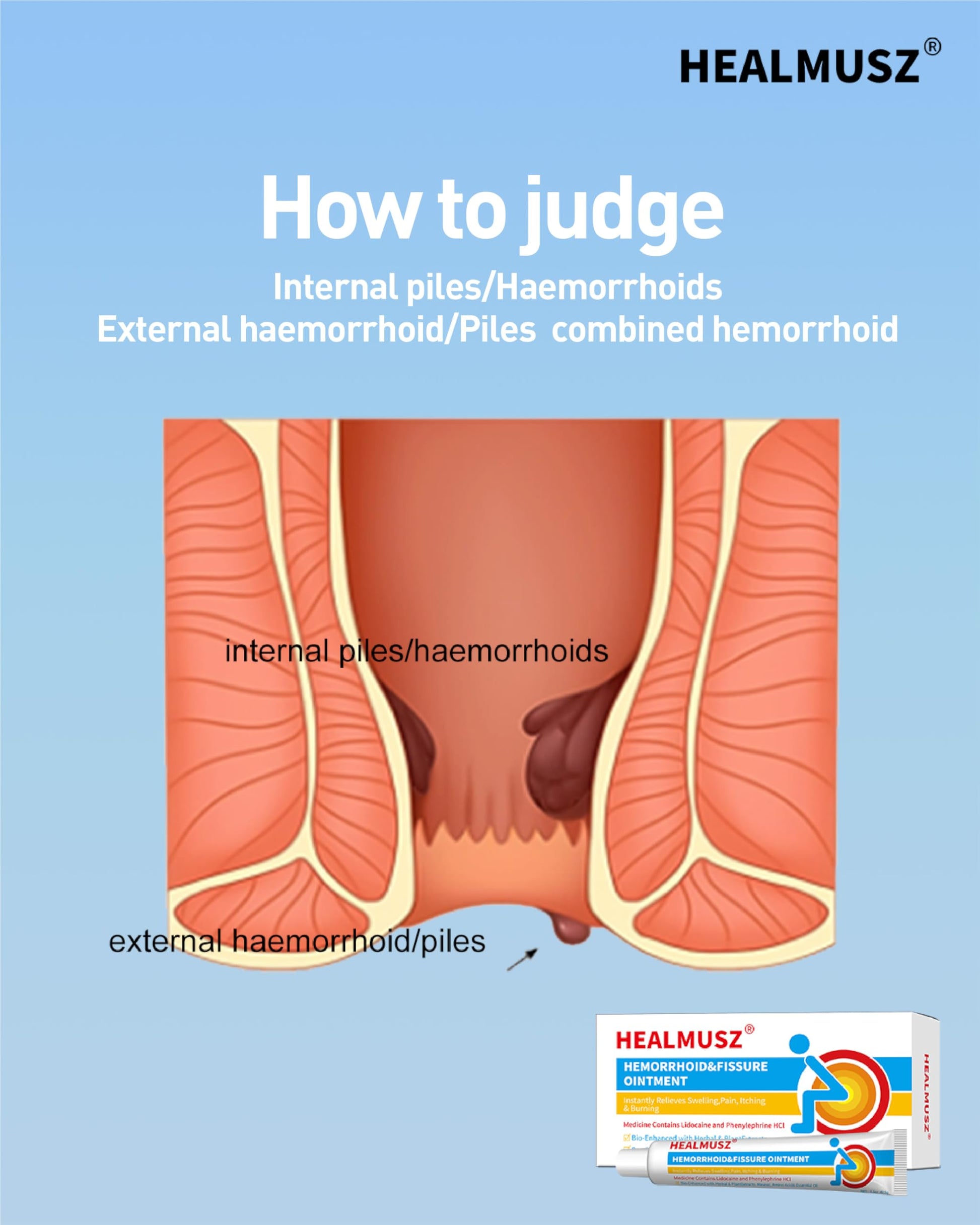 HEALMUSZ Hemorrhoid Fissure Ointment– Hemorrhoid Treatment and Hemorrhoid Cream with Lidocaine and Phenylephrine HCI for Fast Acting Relief of Pain, Swelling, Discomfort, and Itching(1.5 oz) HEALMUSZBuy Supplements Australia