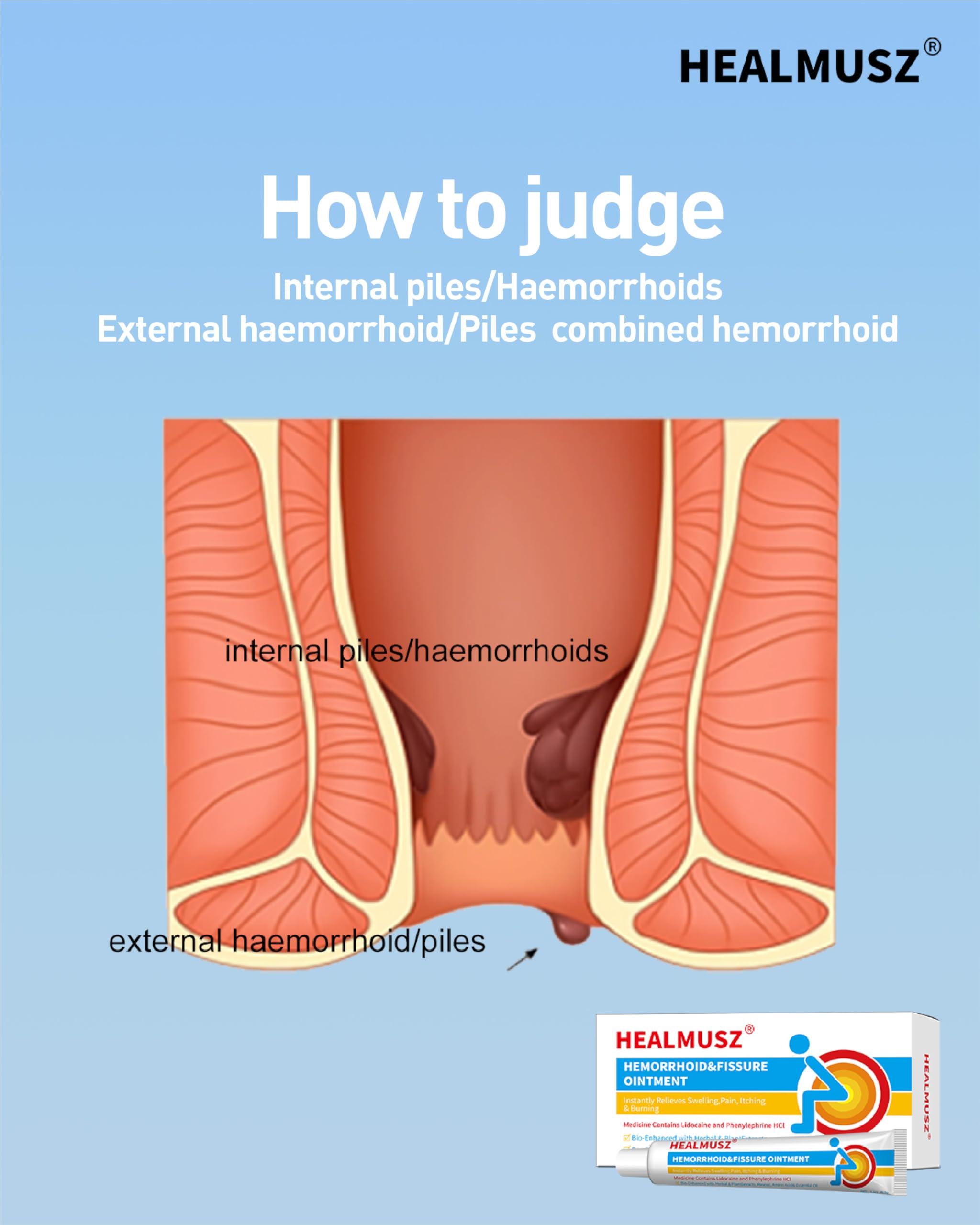 HEALMUSZ Hemorrhoid Fissure Ointment– Hemorrhoid Treatment and Hemorrhoid Cream with Lidocaine and Phenylephrine HCI for Fast Acting Relief of Pain, Swelling, Discomfort, and Itching(1.5 oz) HEALMUSZBuy Supplements Australia
