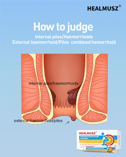 HEALMUSZ Hemorrhoid Fissure Ointment– Hemorrhoid Treatment and Hemorrhoid Cream with Lidocaine and Phenylephrine HCI for Fast Acting Relief of Pain, Swelling, Discomfort, and Itching(1.5 oz) HEALMUSZBuy Supplements Australia