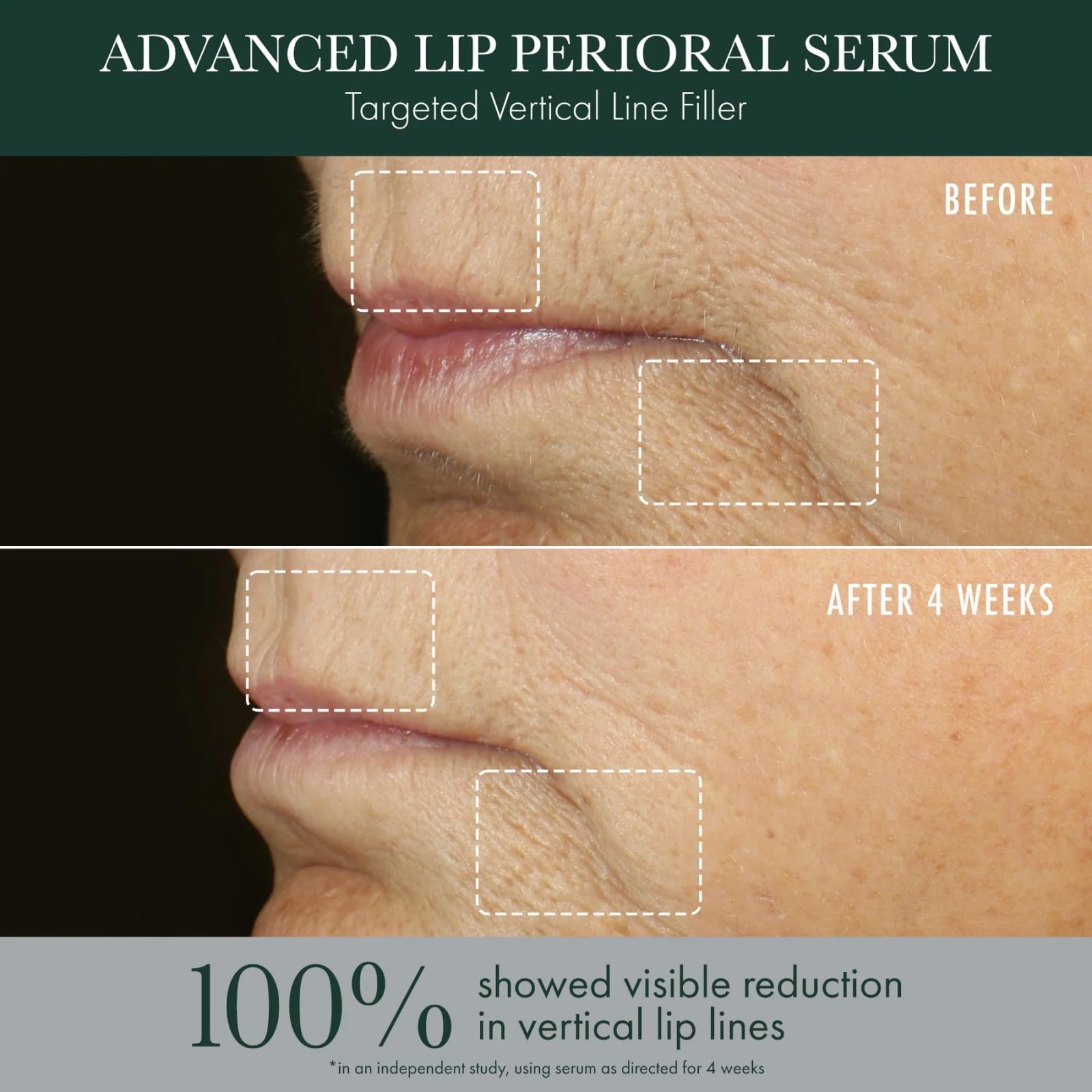 RéVive Advanced Perioral Lip Serum - Anti Aging Perioral Lip Treatment to Reduce Lip Area Lines & Wrinkles -Helps Restore Lip Contour & Visible Fullness(0.5 fl oz) RéViveBuy Supplements Australia