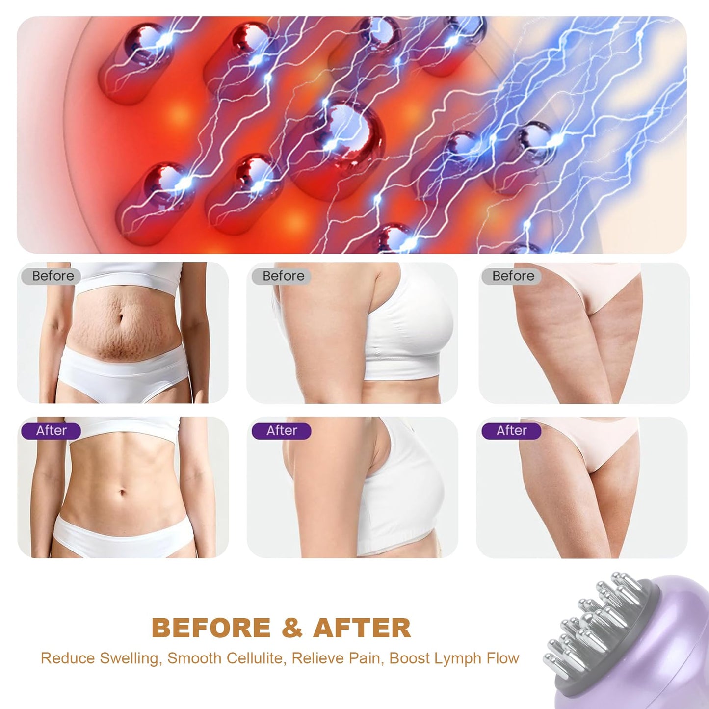 SHANOER 4-in-1 Lymphatic Drainage Massager - Anti Cellulite Massage Tool with Heating/Vibration/Red Light/Microcurrent,Body Sculpting Machine for Legs/Belly/Back/Hips/Reduce Stretch Marks & Cellulite SHANOER buy supplements Au
