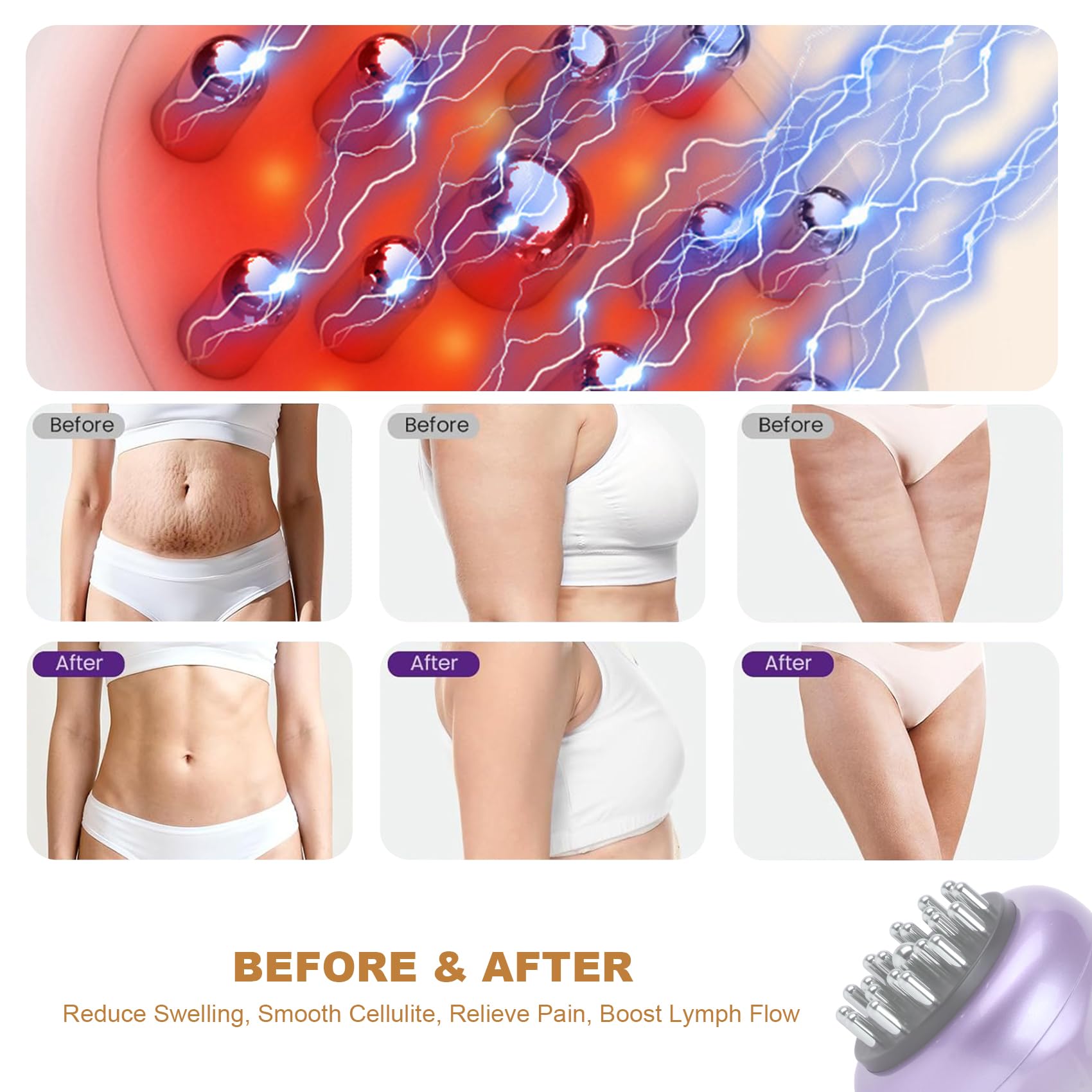 SHANOER 4-in-1 Lymphatic Drainage Massager - Anti Cellulite Massage Tool with Heating/Vibration/Red Light/Microcurrent,Body Sculpting Machine for Legs/Belly/Back/Hips/Reduce Stretch Marks & Cellulite SHANOER buy supplements Au