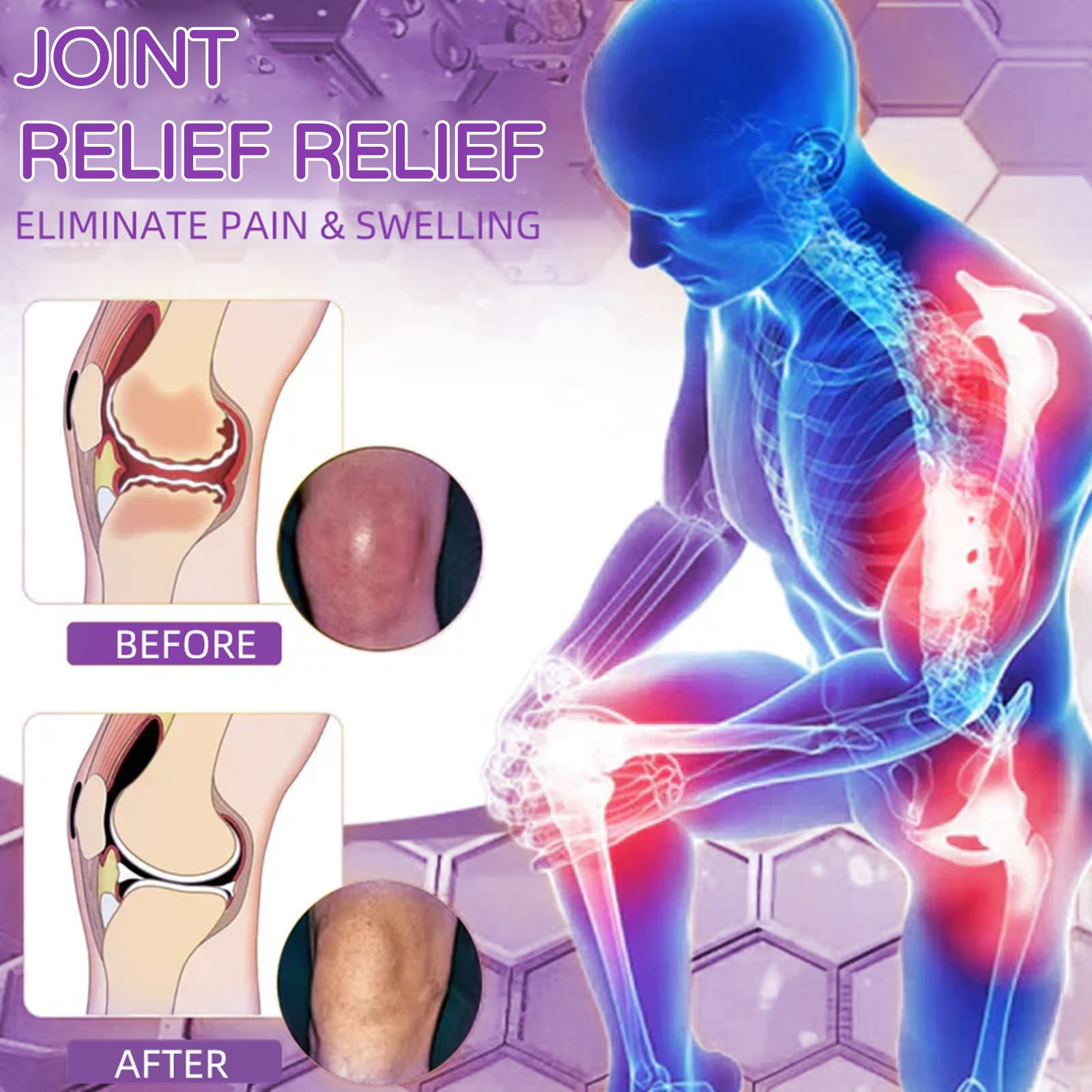 Flexbalm Rapid Joint Relief Therapy Gel 2.0, 2026 New Professional Relief Soothing Massage Gel, Flexbalm Rapid Joint Relief Cream for Back, Knee, Hands, Neck, Feet, for All Skin Types (2 Bottle) dooekaBuy Supplements Australia