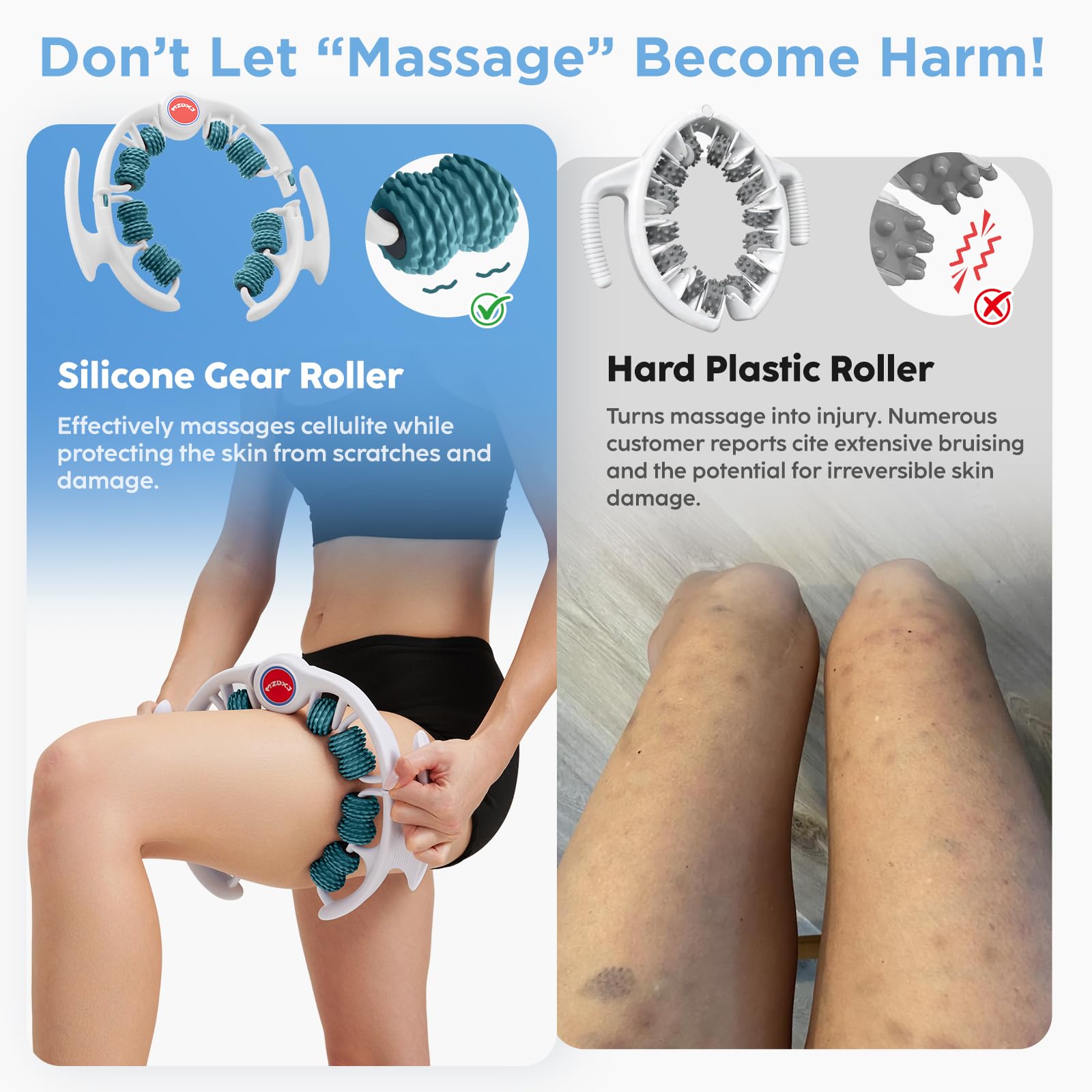MZDXJ Cellulite Massage Tool - Lymphatic Drainage Massager - Muscle Roller, Deep Fascia Massage, Dimpled Skin Removal, Legs/Thighs/Buttocks, Anti-Cellulite Roller, Smooth Skin (14 Wheel - Green) MZDXJ buy supplements Au