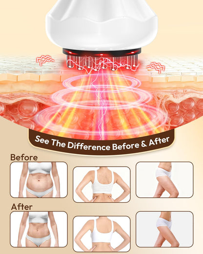 Glamesty Lymphatic Drainage Massager & Anti Cellulite Massage Tool, Body Sculpting Machine with Light, Soothing Pulse, Heat & Vibration, Heated Lymph Brush for Legs, Hip, Arms, Belly (White) Glamesty buy supplements Au