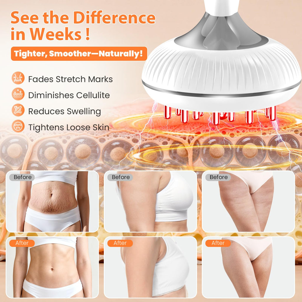 Choufaly Lymphatic Drainage Massager & Anti Cellulite Massage Tool, Helps Reduce Stretch Marks & Cellulite, for Legs, Arms & Belly, Body Sculpting Machine with Microcurrent & Light & Heat & Vibration Choufaly buy supplements Au