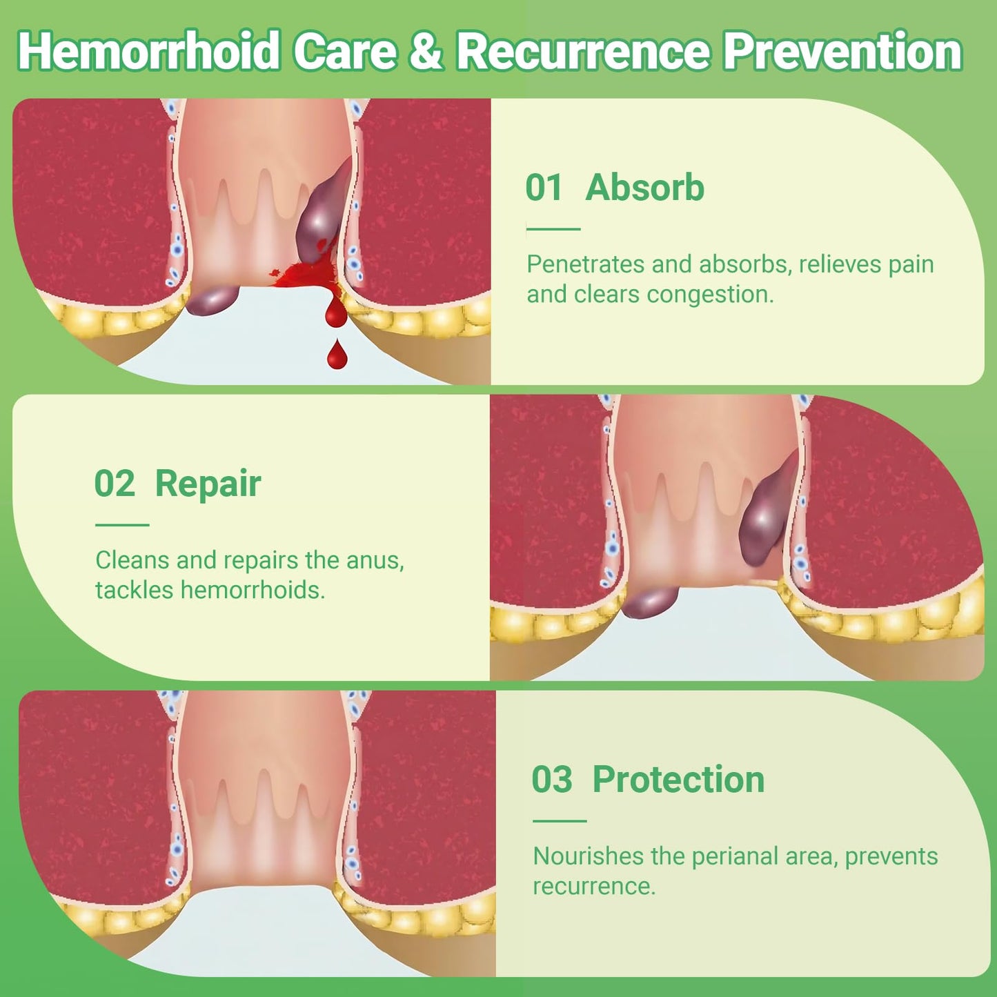 Hemorrhoid Treatment Ointment - Tubesmaximum Strength - Fast Relief from Pain, Itching, Burning, Swelling & Fissures | Natural Aloe & Vitamin E | Travel-Friendly10g x 5 Pieces Tubes - (1.76 Oz) yimimdeBuy Supplements Australia