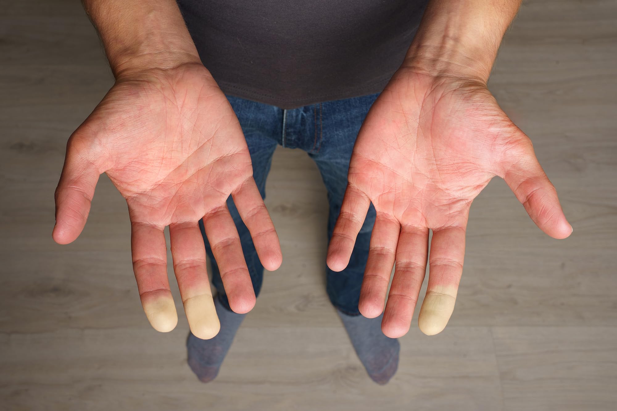 Extremity Warmth - for Cold Hands and Feet GenericBuy Supplements Australia