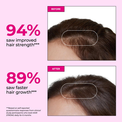 HUM Hair Strong Daily Hair Growth Gummies with Biotin, Zinc, Vitamin B12 to Support Growth, Folic Acid & Vitamin B12 Gummy Vitamins for Healthy Hair Support for Women and Men, 60 Gummies HUMBuy Supplements Australia