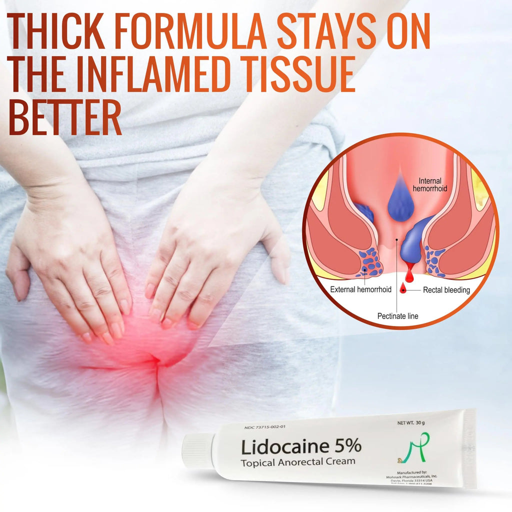 Mohnark Maximum Strength Lidocaine Hemorrhoid Treatment Cream for External and Internal Hemorrhoids Treatment Burn Itch Pain Relief Anal Cream Topical Anorectal Numbing Cream- 30 Gram Tube Made in USA MOHNARKBuy Supplements Australia