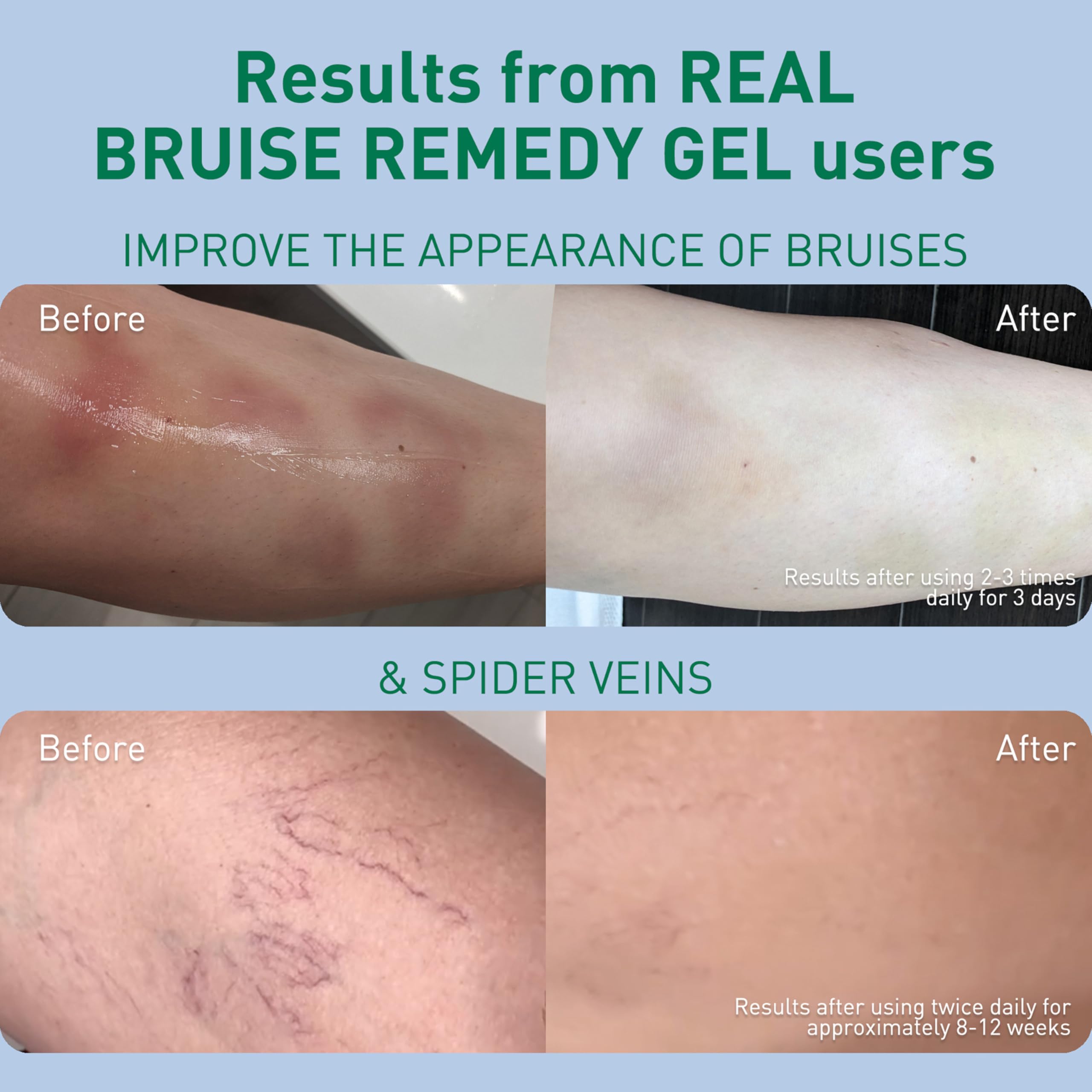 PROcure Arnica & MSM Bruise Remedy Gel – Paraben-Free, Unscented Arnica Montana Gel for Bruising, Spider Veins & Skin Discoloration – 2 Pack PROcureBuy Supplements Australia