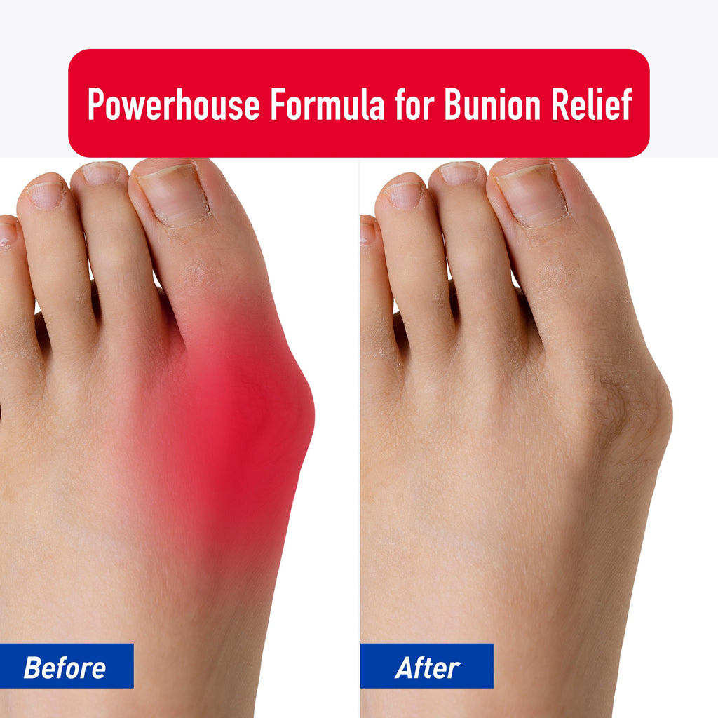PROFOOT Bunion Relief Rub, White Heal&RescueBuy Supplements Australia