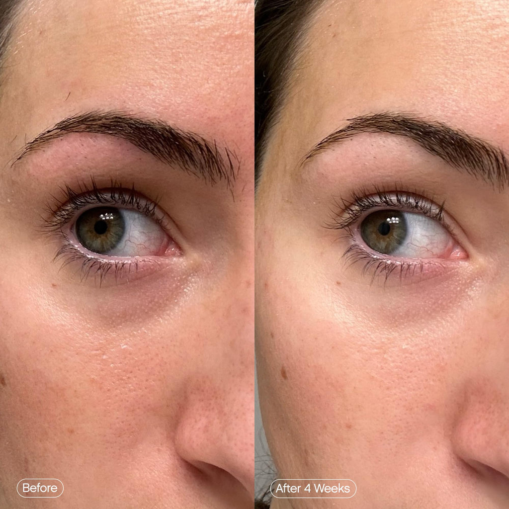 Topicals Faded Brightening Under Eye Masks | Patches to Depuff, Hydrate, Brighten and Cool | Reduce Dark Circles and Fine Lines | Contains Kojic Acid, Caffeine and Niacinamide (Set of 6) TopicalsBuy Supplements Australia