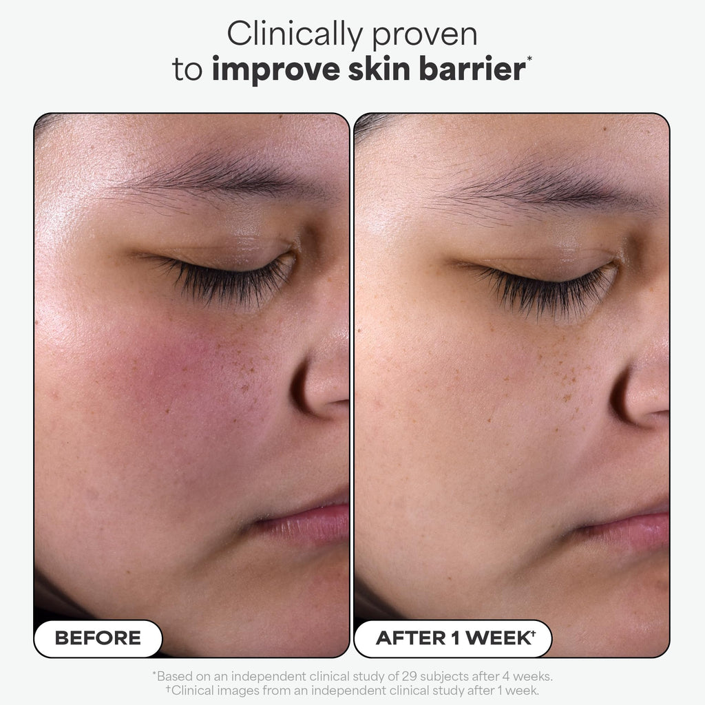 Paulas Choice--SKIN PERFECTING 2% BHA Liquid Salicylic Acid Exfoliant--Facial Exfoliant for Blackheads, Enlarged Pores, Wrinkles & Fine Lines, 4 oz Bottle Paula's ChoiceBuy Supplements Australia