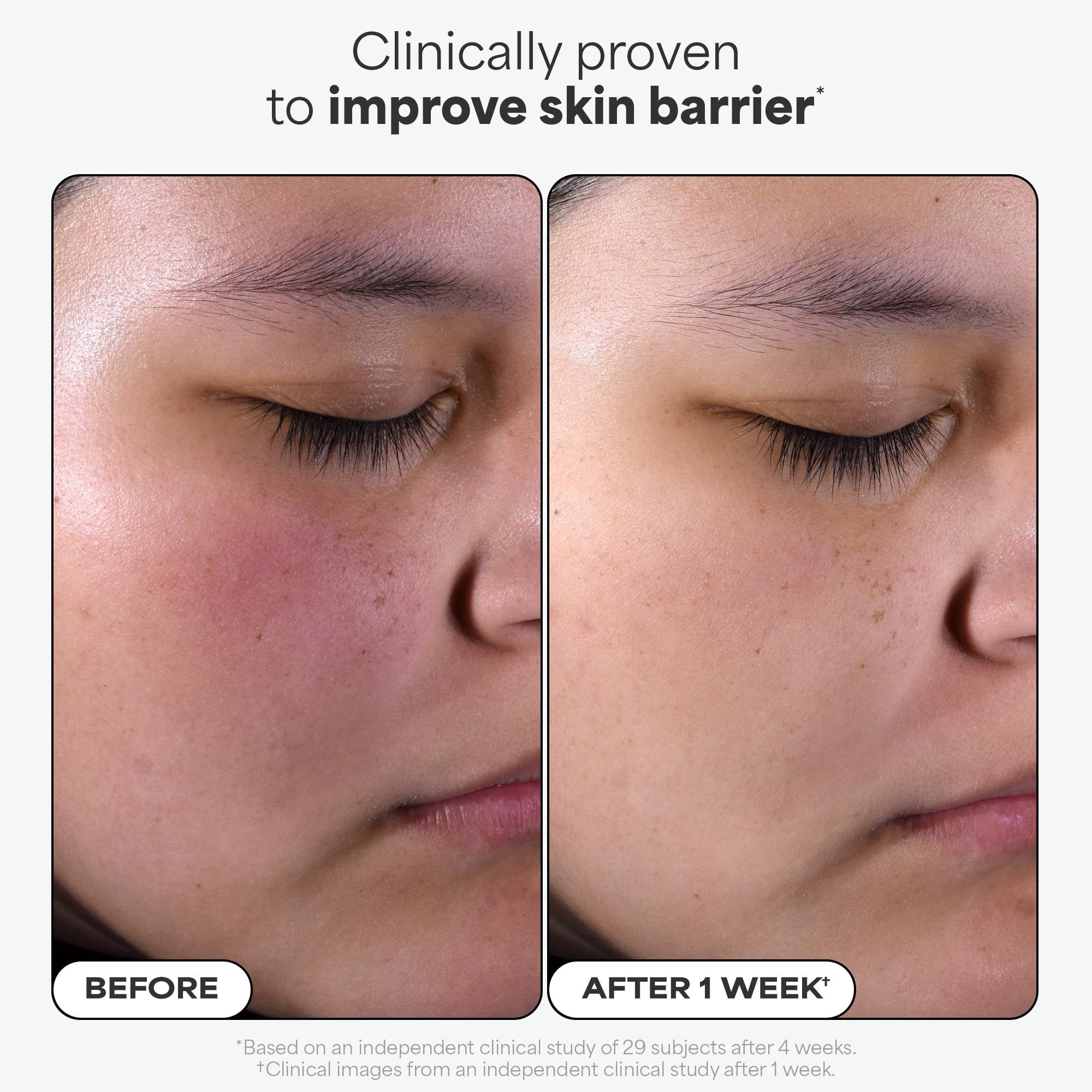 Paulas Choice--SKIN PERFECTING 2% BHA Liquid Salicylic Acid Exfoliant--Facial Exfoliant for Blackheads, Enlarged Pores, Wrinkles & Fine Lines, 4 oz Bottle Paula's ChoiceBuy Supplements Australia
