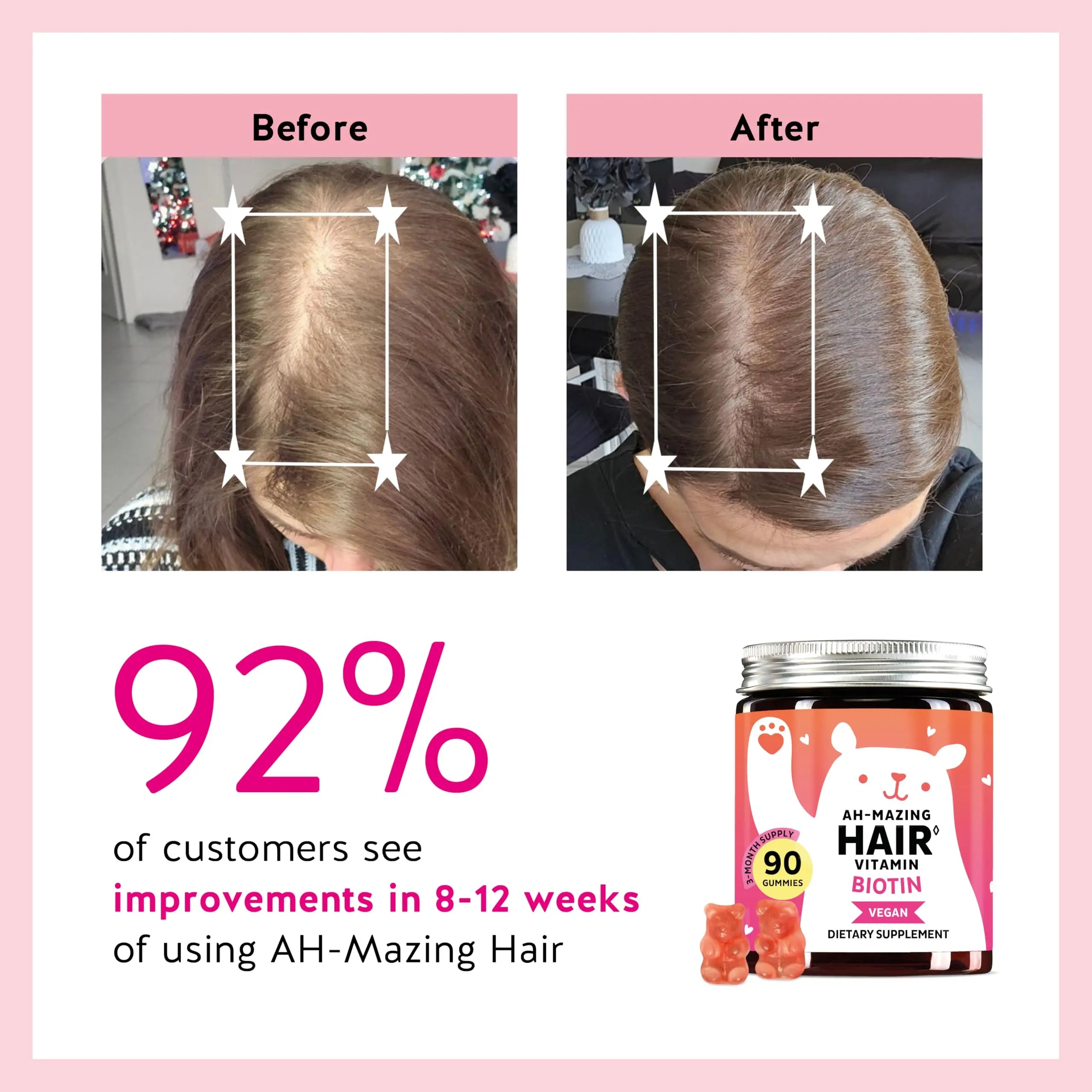 Biotin Gummies for Hair, Skin & Nails. 5,000 mcg High Potency Vegan Vitamins for Faster Hair Growth, Stronger Nails & Healthy Skin. with Vitamins C & E, 90 Gummies Bears with Benefits