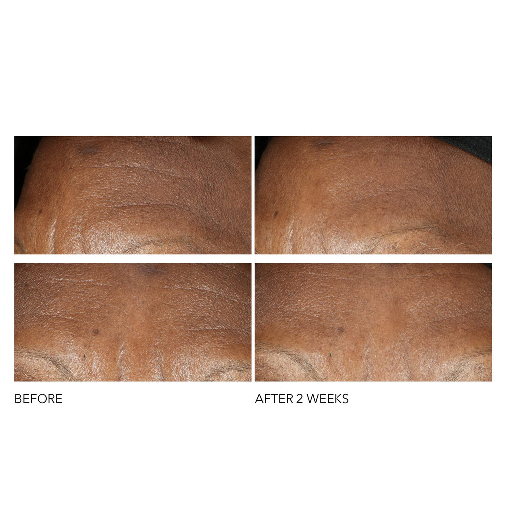 Dr Dennis Gross Advanced Retinol + Ferulic Intense Wrinkle Cream | Intensely Hydrating to Visibly Transform Skin and Repair the Moisture Barrier | 2 oz Dr Dennis GrossBuy Supplements Australia